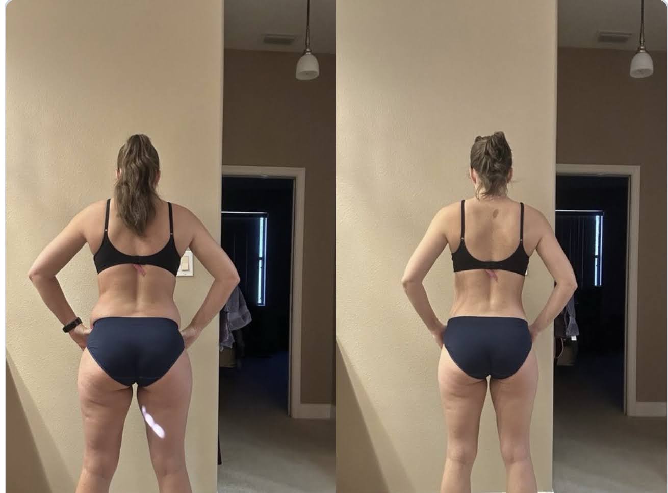Kimberly H.: Flex Appeal client before and after