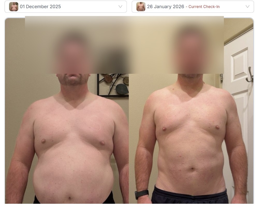 Michael G.: Flex Appeal client before and after